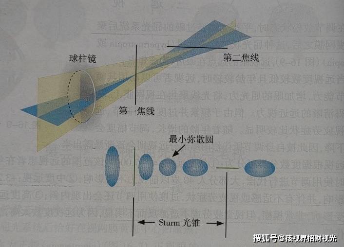 由于眼球在不同子午线上屈光力不同,平行光线经过该眼球屈光系统后不