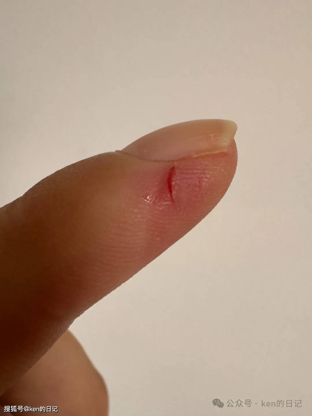 龚翔日记:我被巴西龟咬破手指流血了