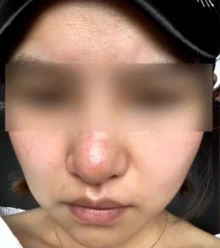 女子隆鼻失败欲维权 记者陪同却遭贵阳妍僖整形医院暴力阻拦(图3)