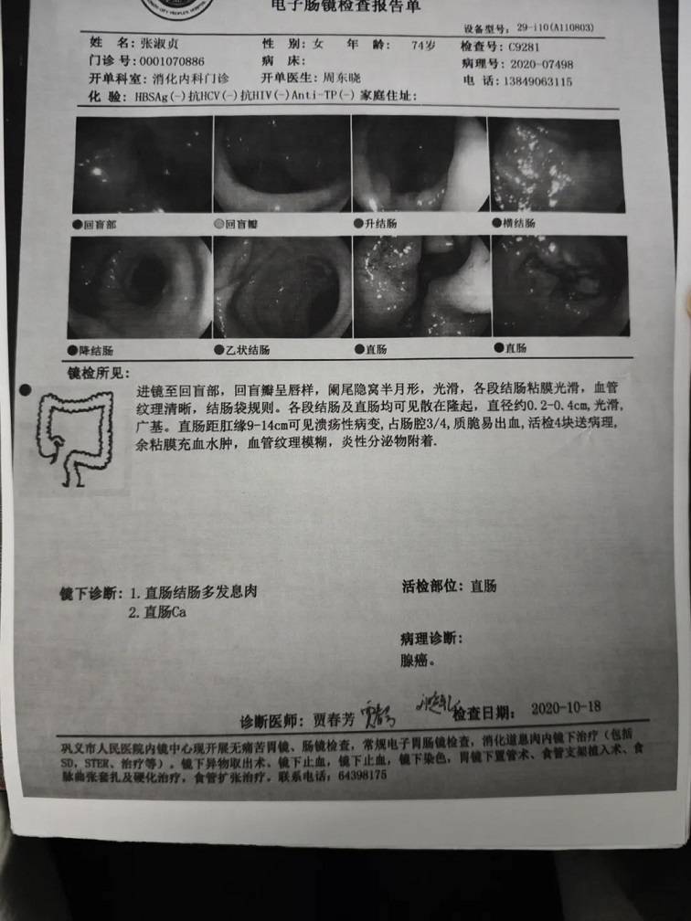 肠镜检查害我一生图片