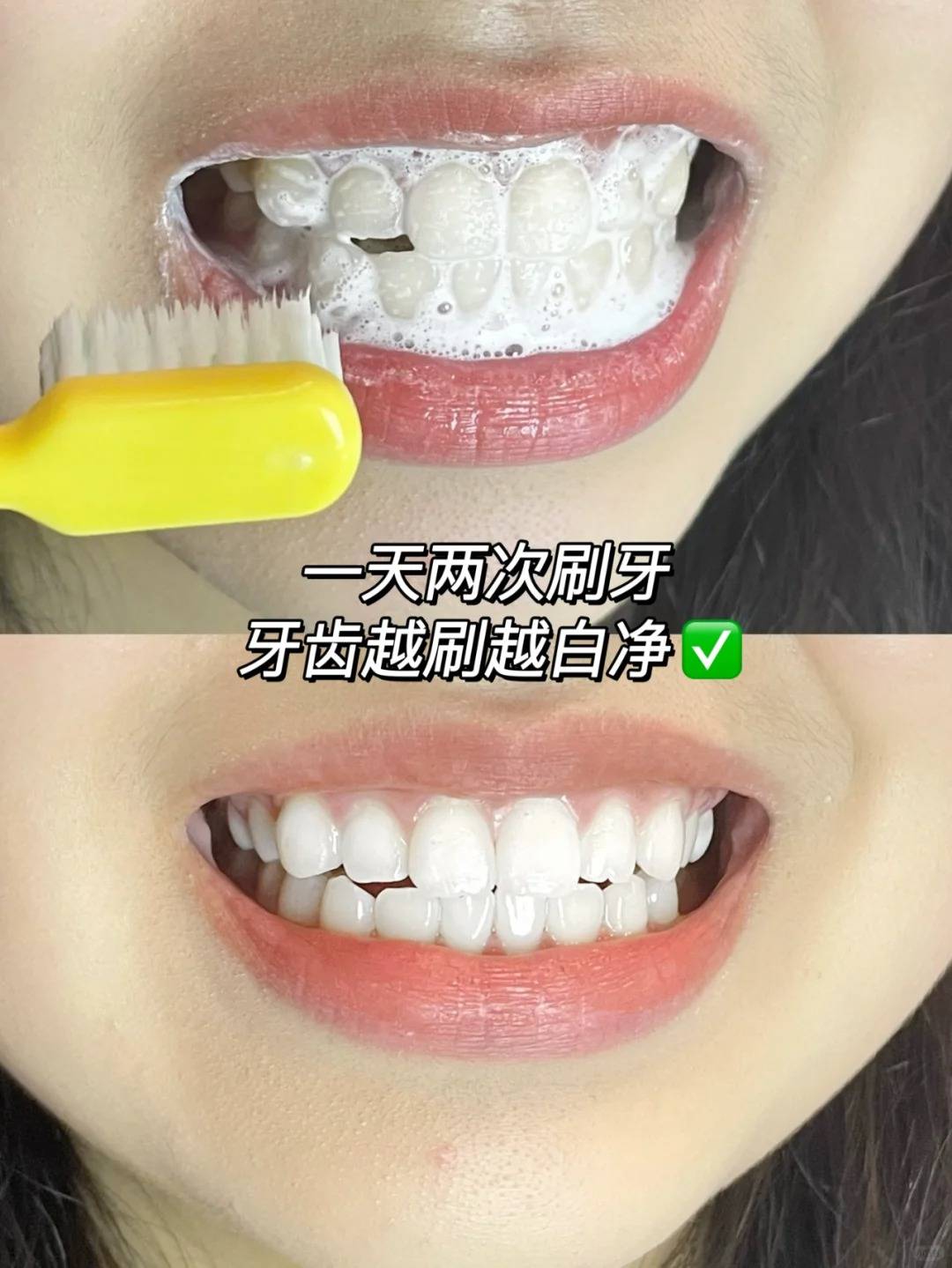 牙黄怎么变白简单方法(牙黄怎么变白简单方法又安全) 第2张