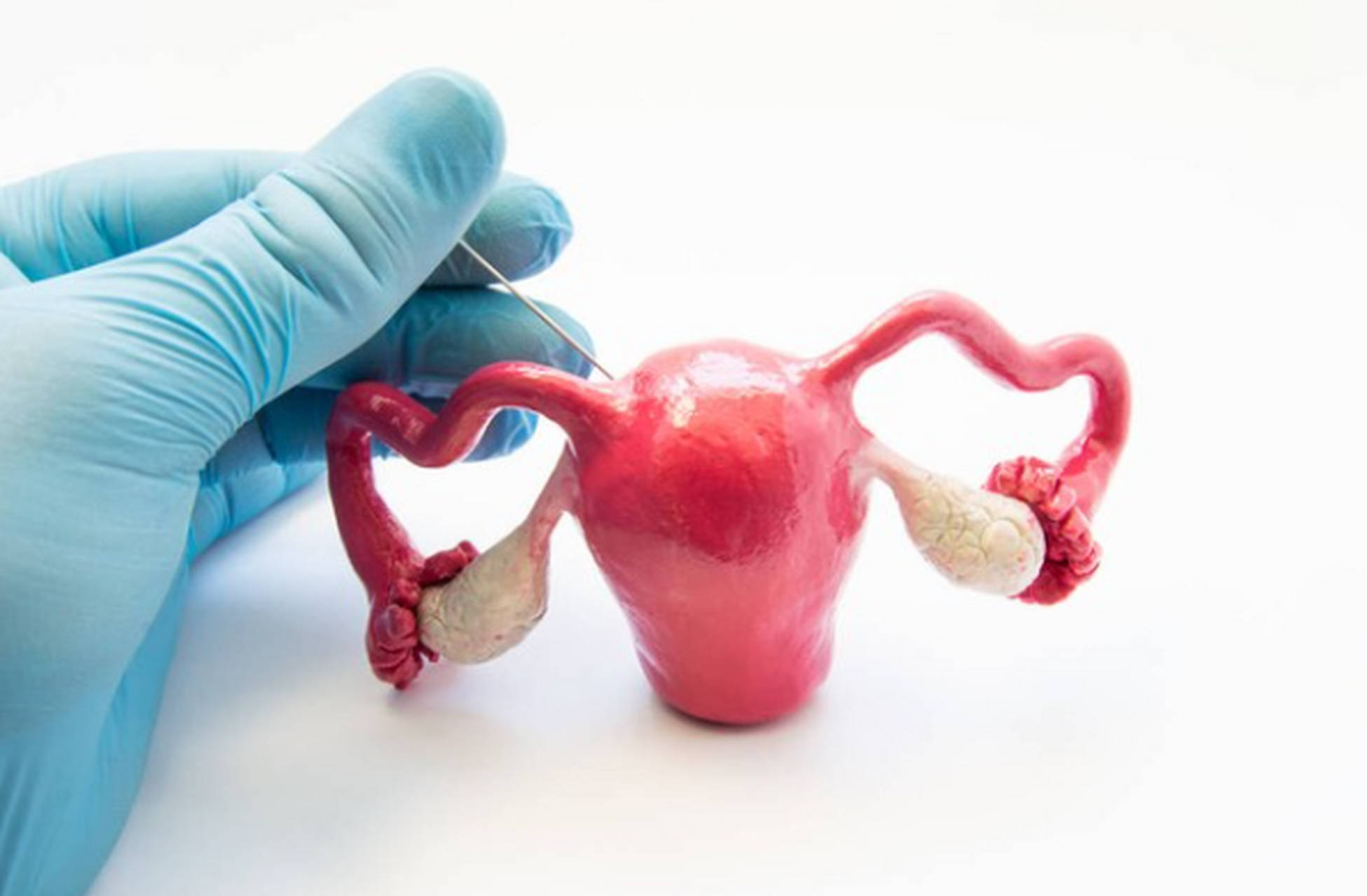 这9类因素,都容易患卵巢囊肿,长期出现这些症状,及时就医