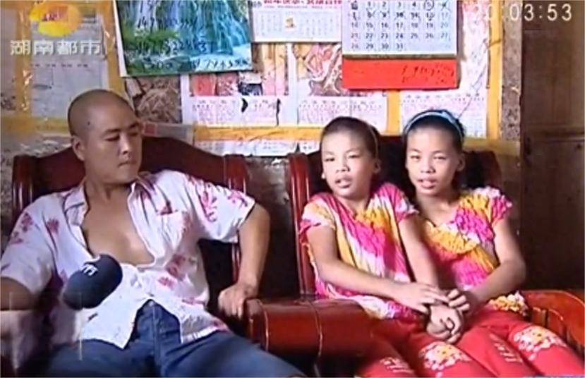 双胞胎女儿声音男化,检查结果却是男孩?孩子妈妈:当初不该冲动_搜狐网