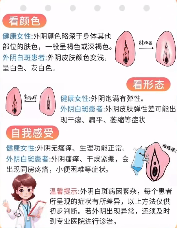 妇科病白斑图片