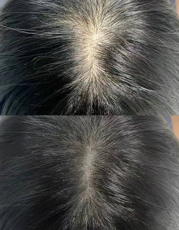 育发黄金法则大公开,脱发星人秒变发量王者不是梦_头发_梳子_头皮