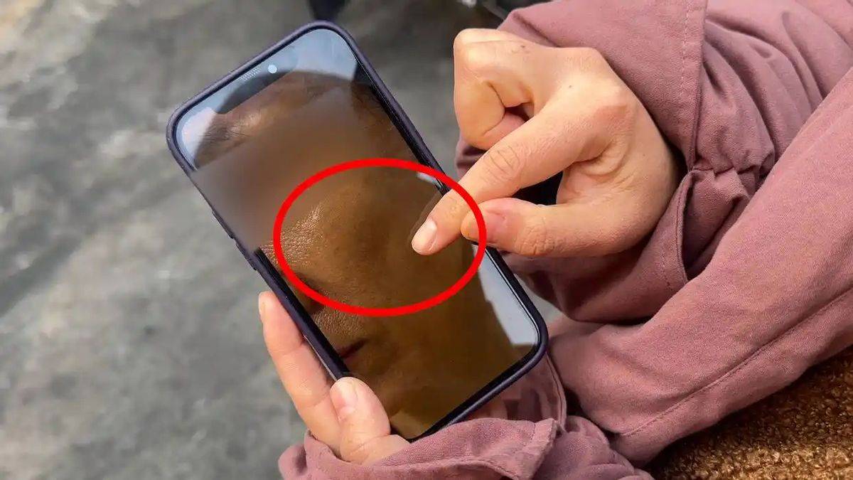 18万元除皱针打出俩大坑 青岛花际医美跨区执业不是头一回(图4)