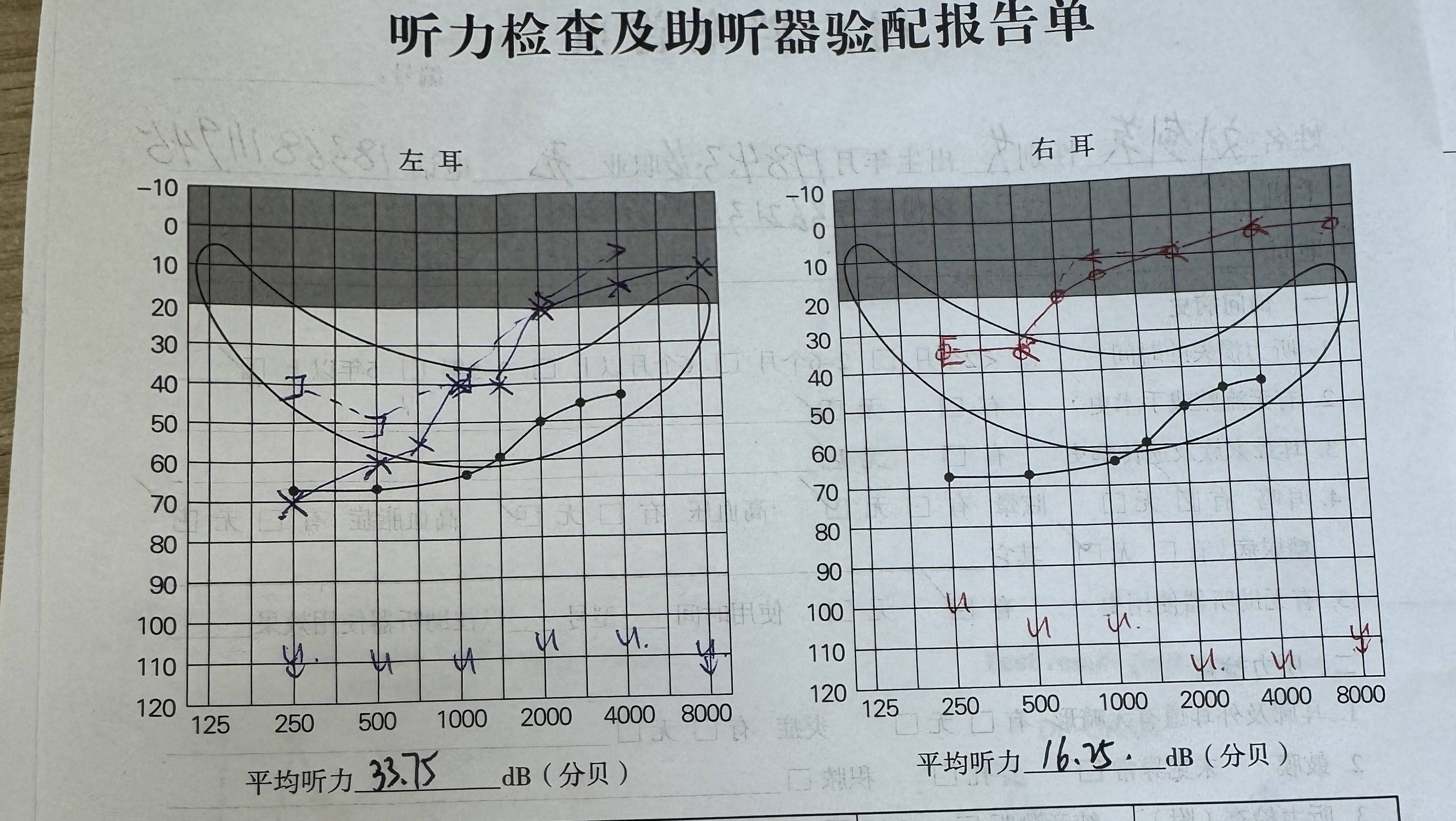 —许弘毅博士门诊案例分析!