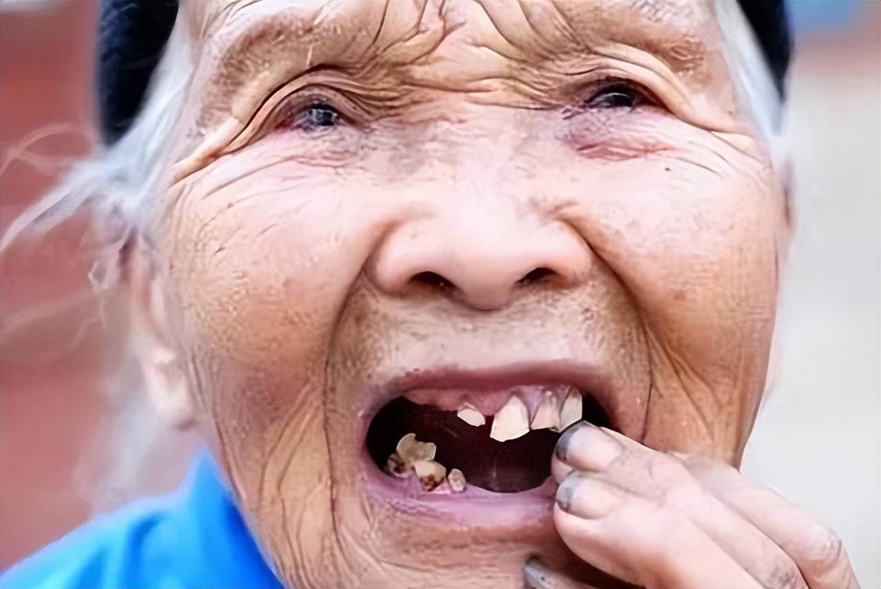 牙齿脱落后,需要注意哪些事?