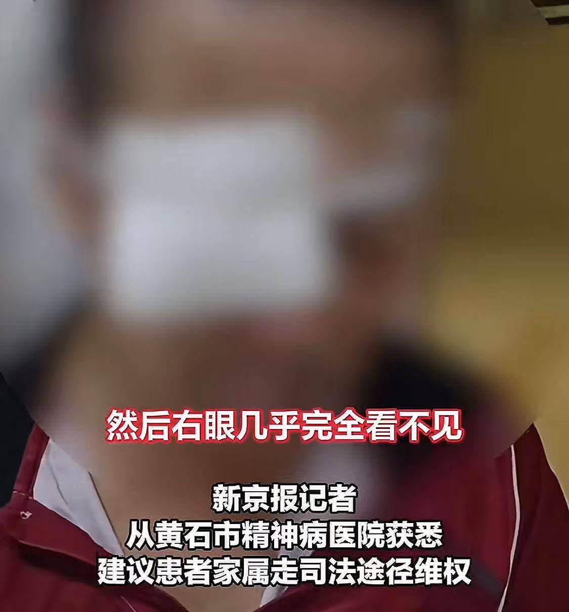 老年人得精神病(老年人得精神病能送精神病院吗)
