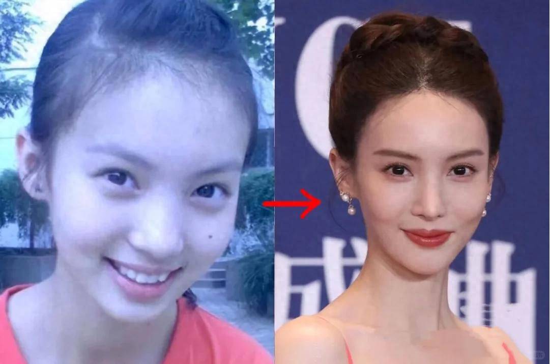 这一次,谁都救不了金晨,暴瘦脱相,过度医美,畸形审美毒害下的她!