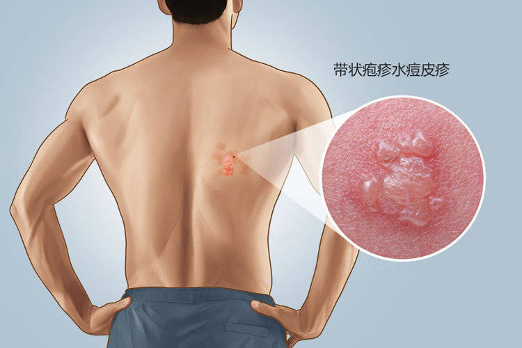 提醒医生：父母超过50岁之后，他们应该
