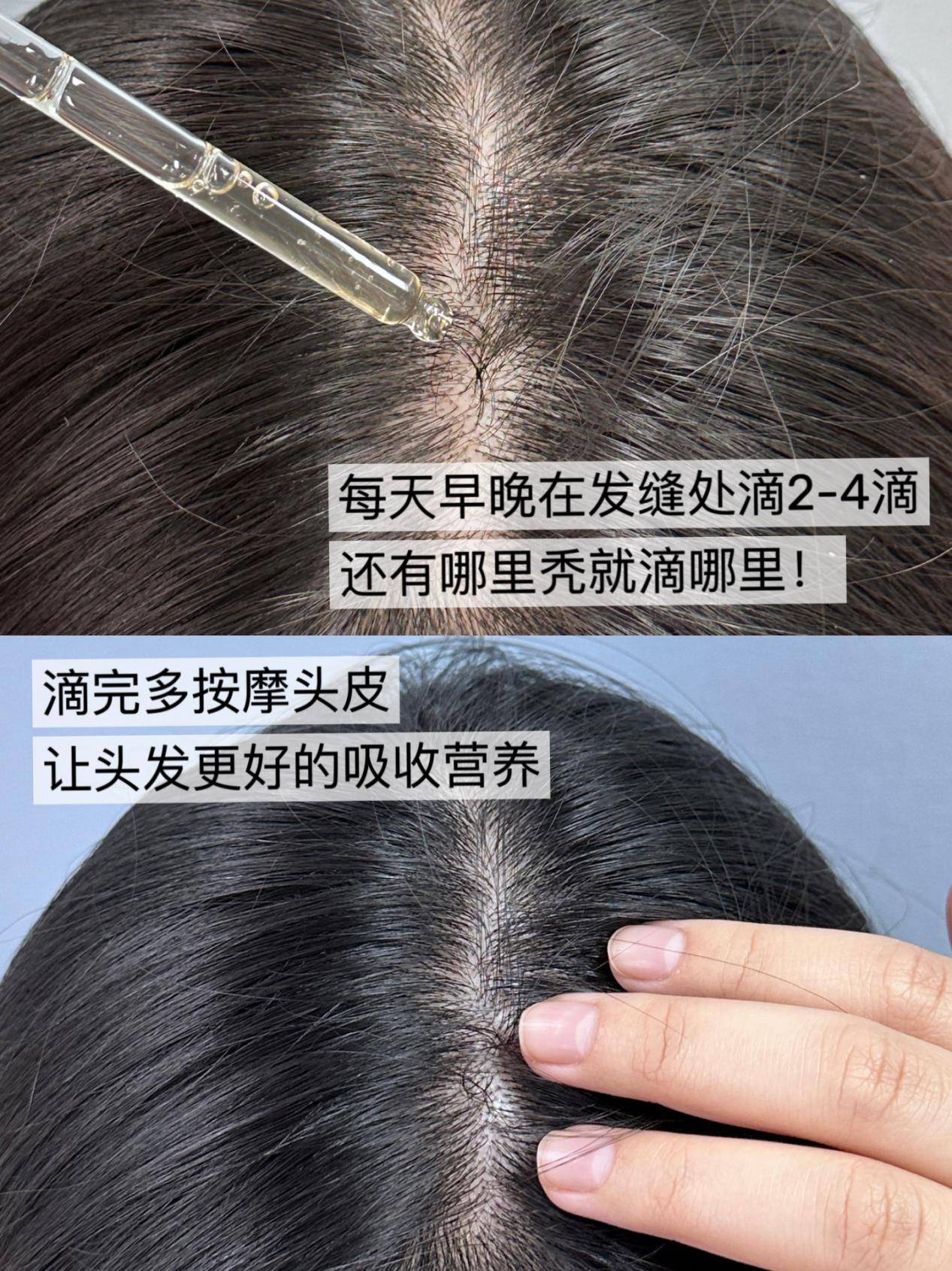 世界公认有效十大防脱生发品牌脱发别错过