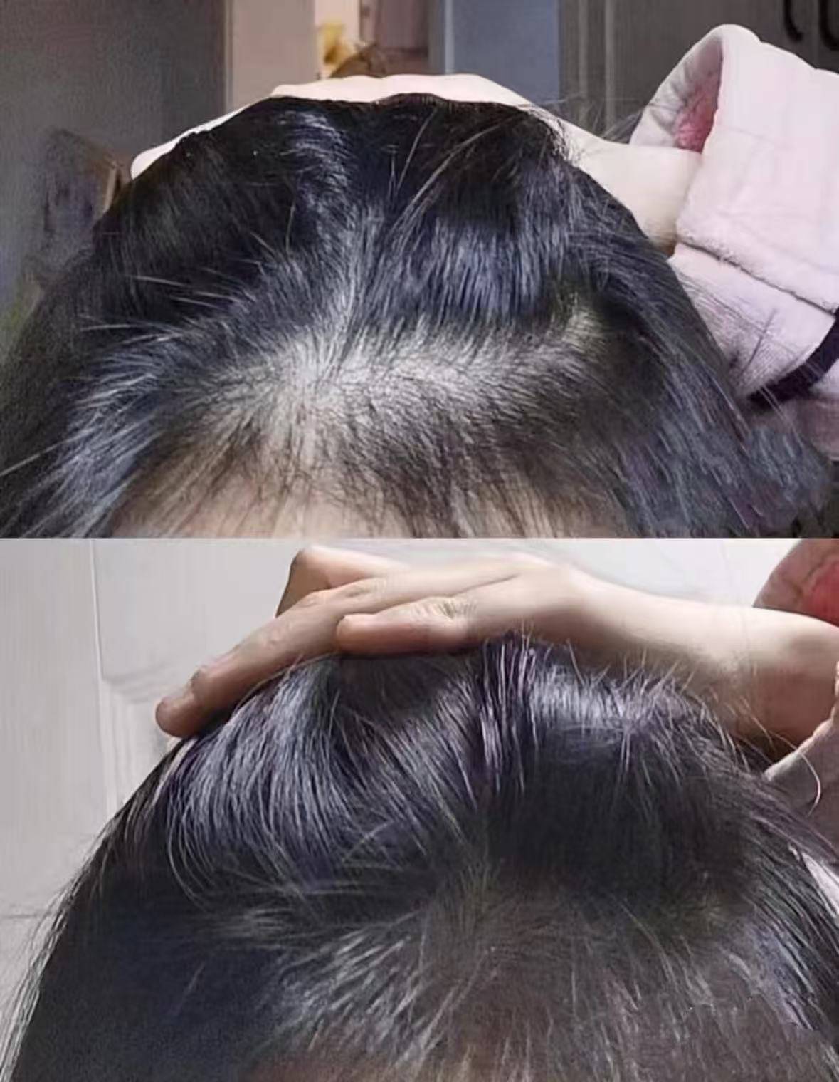 世界十大防脱生发液排行榜央视认可的育发液排名第一实力不虚
