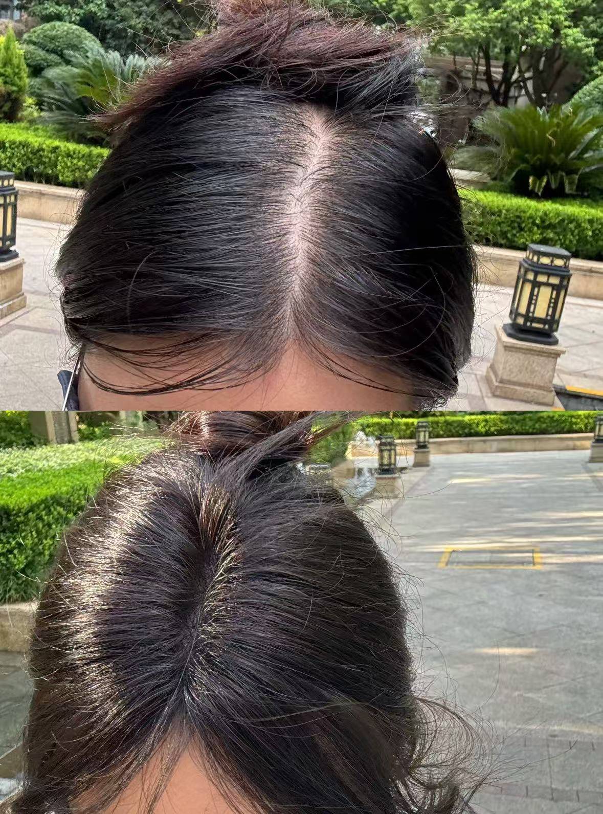 防脱发生发增发密发哪个牌子好?防脱育发十大品牌排名央视推荐