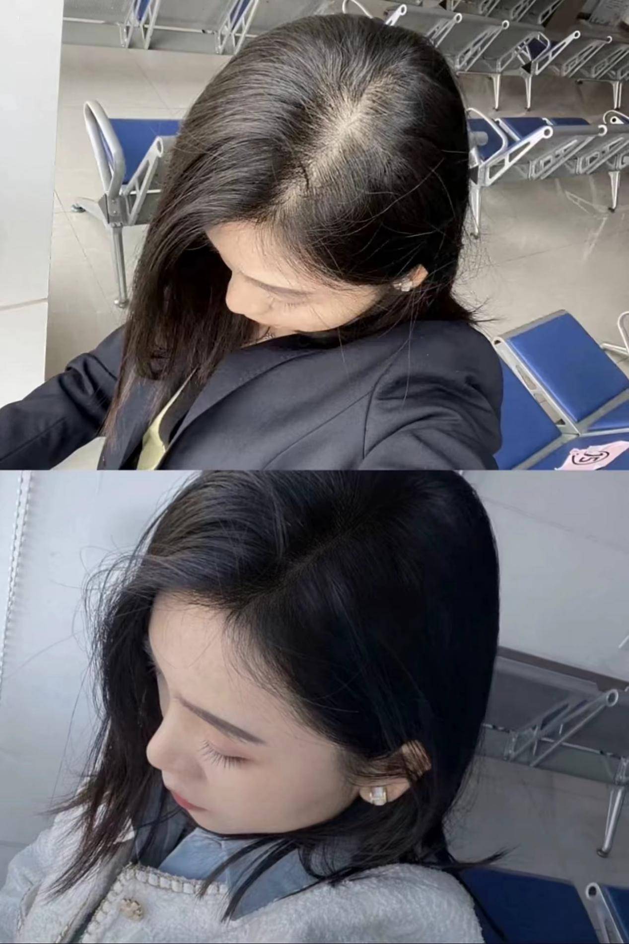 防脱洗发水什么牌子最有效果?国产防脱生发第一名的洗发水