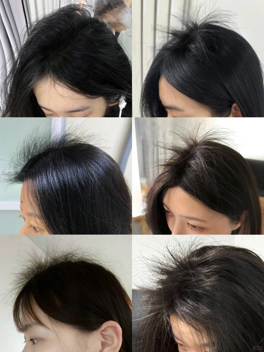 25年生发育发最有效的产品排名国药唯一承认的防脱生发液品牌养发