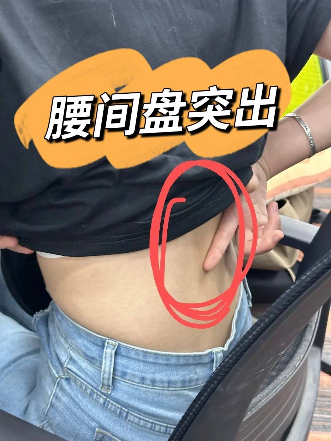 腰突3年靠这5招终于把腰养回来了