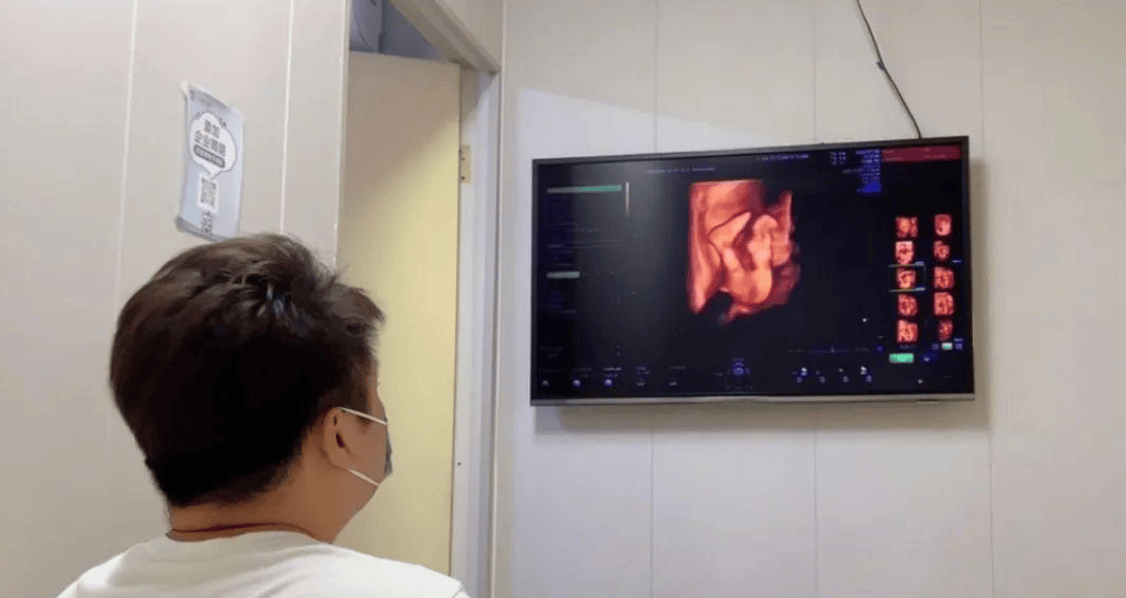 孕晚期胎动像心跳一样是怎么回事？可能是胎儿在打嗝