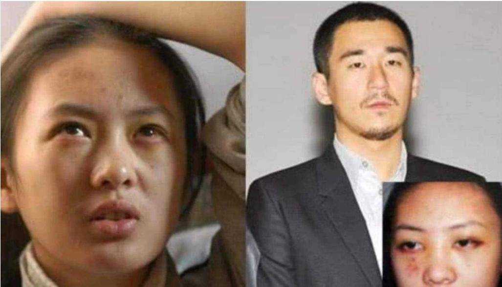 "小章子怡"童谣:被男友家暴,事业一落千丈,现在嫁富商成视后