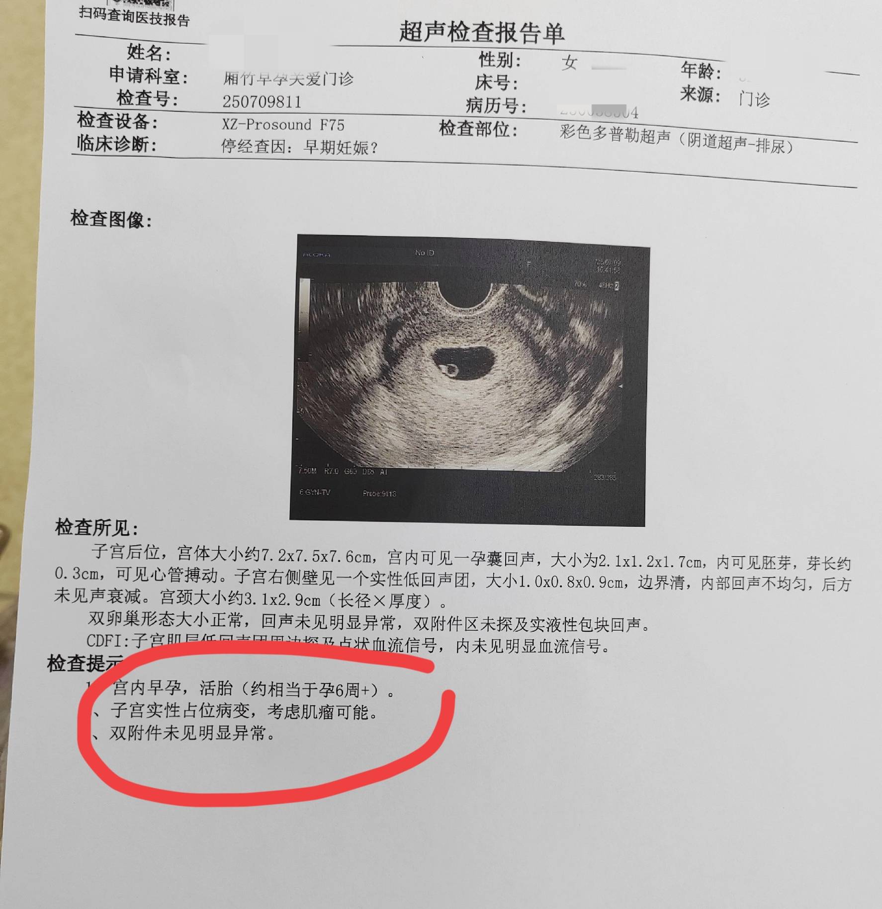 多数胎儿都不能按预产期出生的原因？医生没说原因,妈妈也要知道