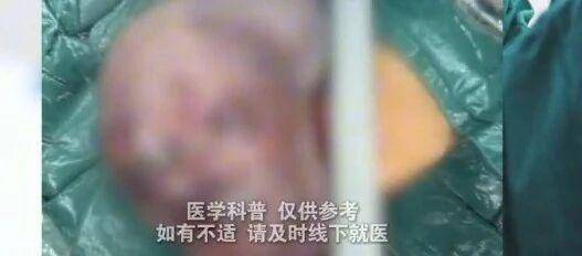 地坛医院乙肝可以100%治愈号贩子挂号电话，挂不上的都找我专业解决各种高难度就医问题的简单介绍