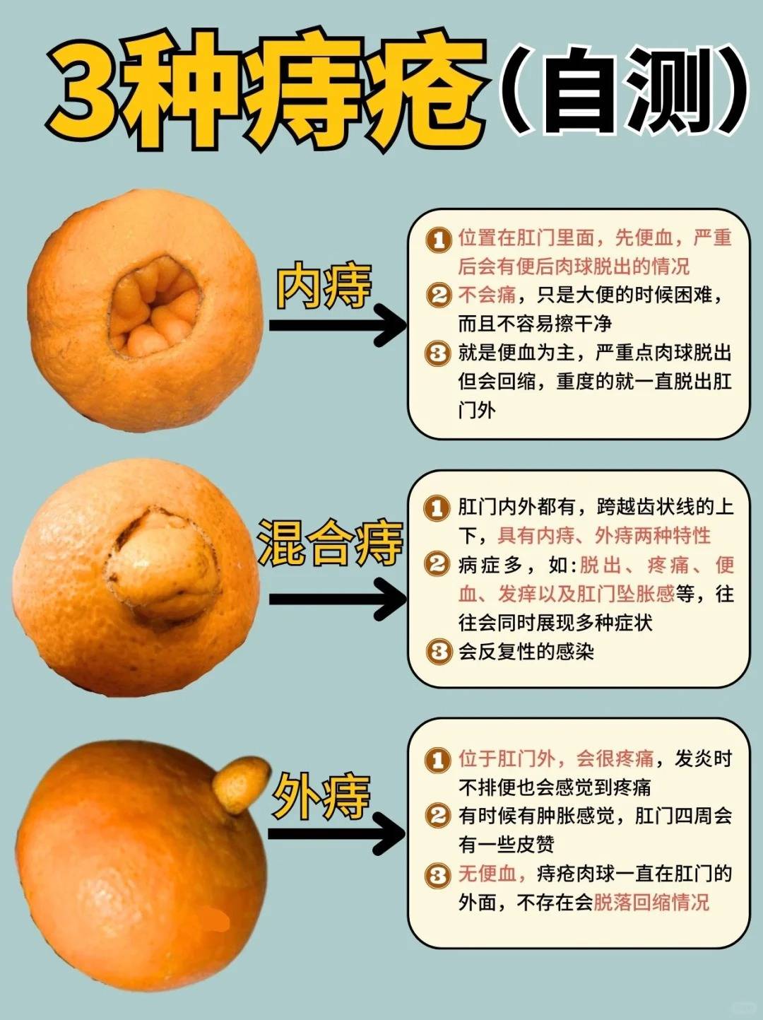 得了痔疮日常该如何护理!