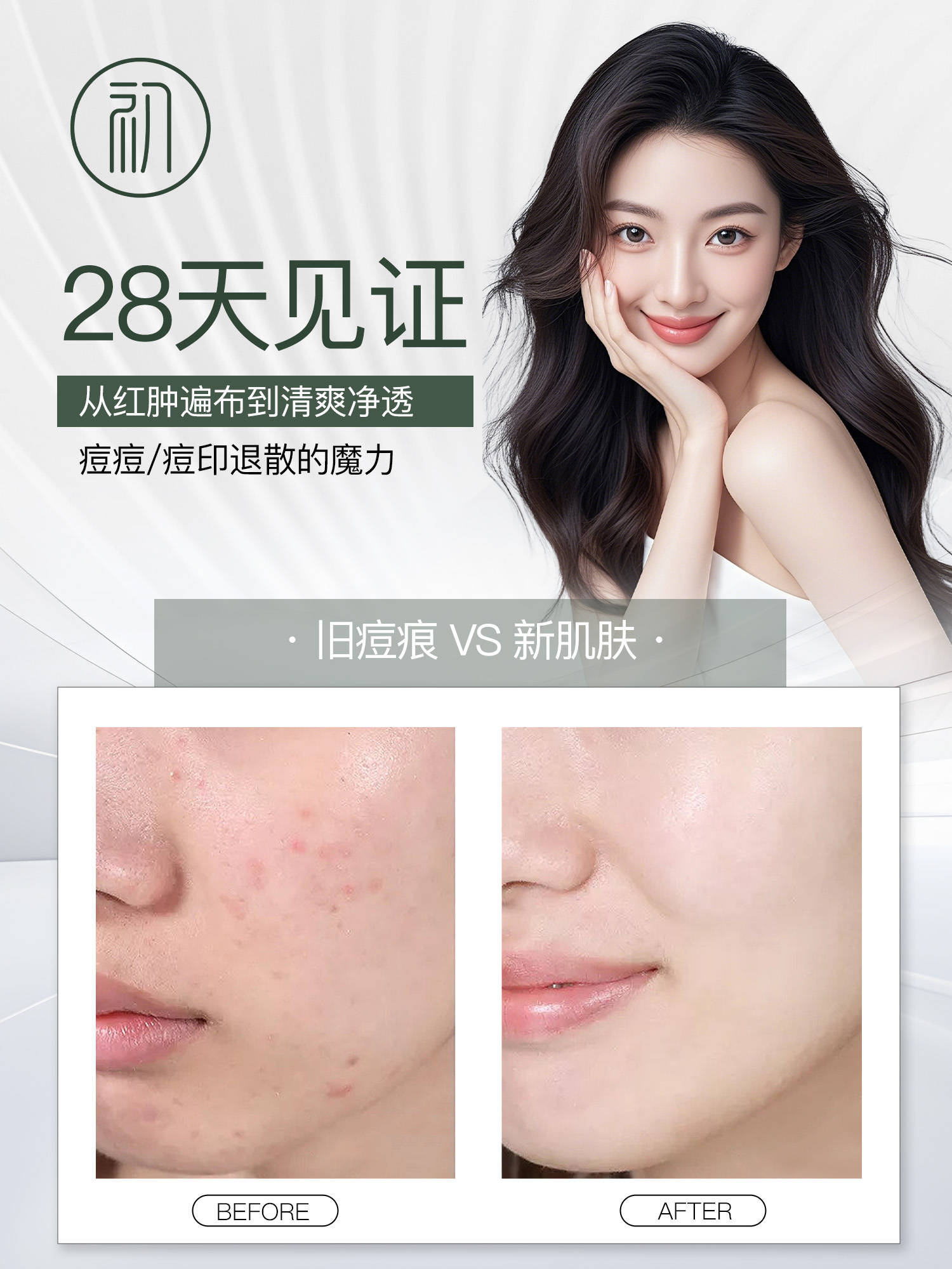 连续使用两周痘痘问题明显改善不仅新痘很少萌发连顽固的闭口也