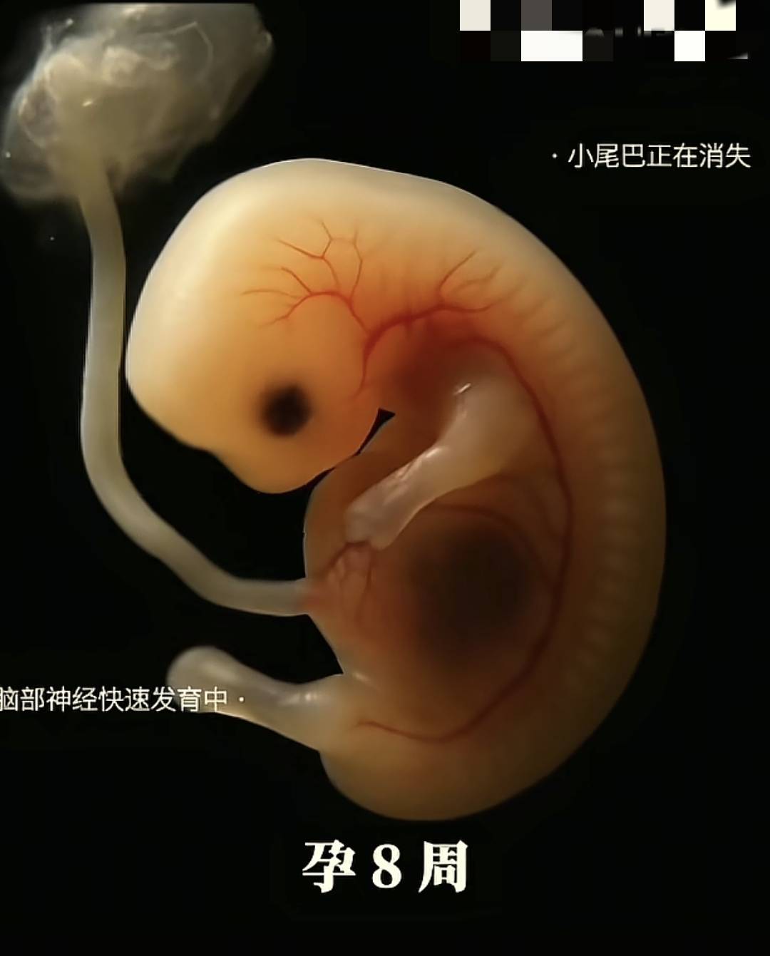 从胚胎到变成胎儿这个孕早期的过程到底是怎么样的？