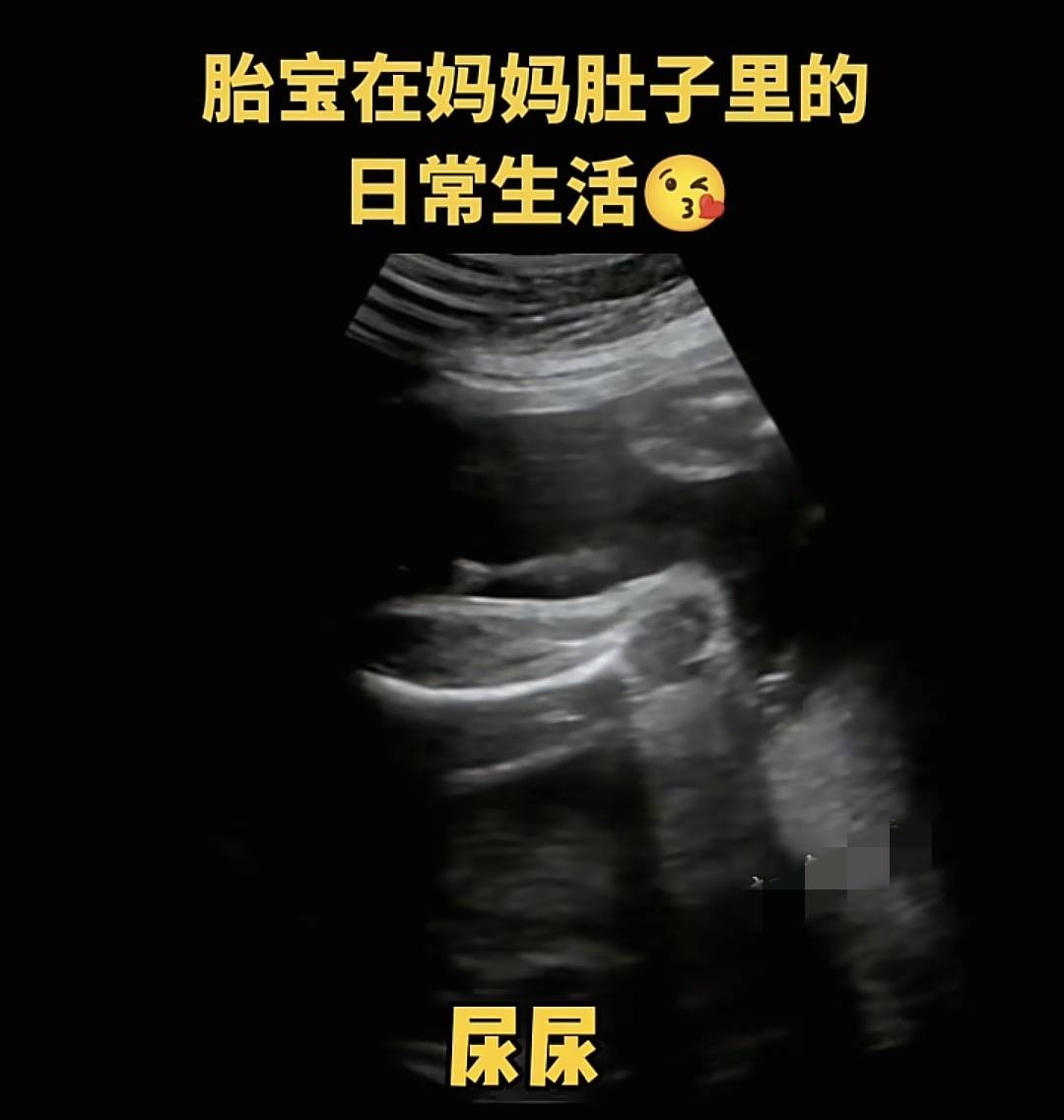 宝宝在妈妈肚子里会无聊吗？一组图告诉你胎宝在子宫里很欢乐