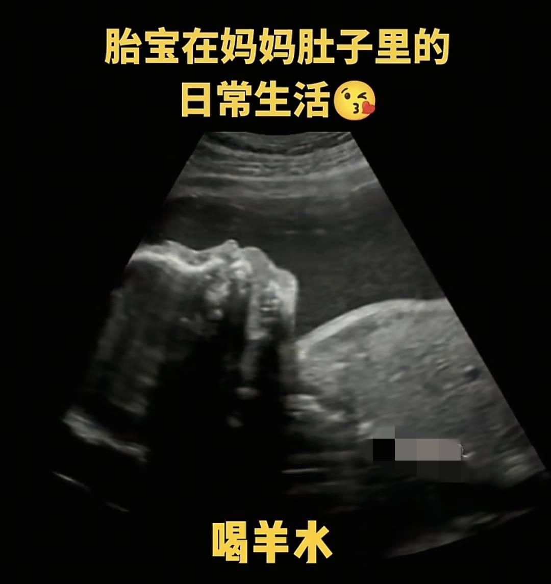 宝宝在妈妈肚子里会无聊吗？一组图告诉你胎宝在子宫里很欢乐