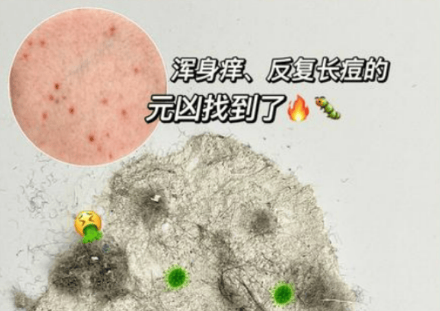 除螨仪排行榜前十有哪些？实测排行榜前十人气除螨仪品牌推荐！