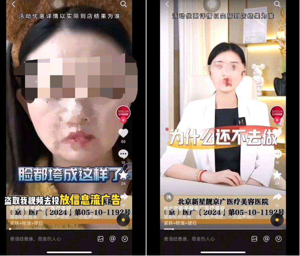 被消费者曝光虚假宣传后 北京新星靓医美再曝肖像权风波(图4)