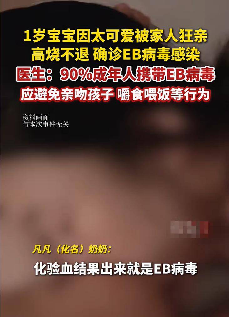 奶奶频繁亲吻孩子致其确诊亲吻病,导致10岁男孩脖子长肿块