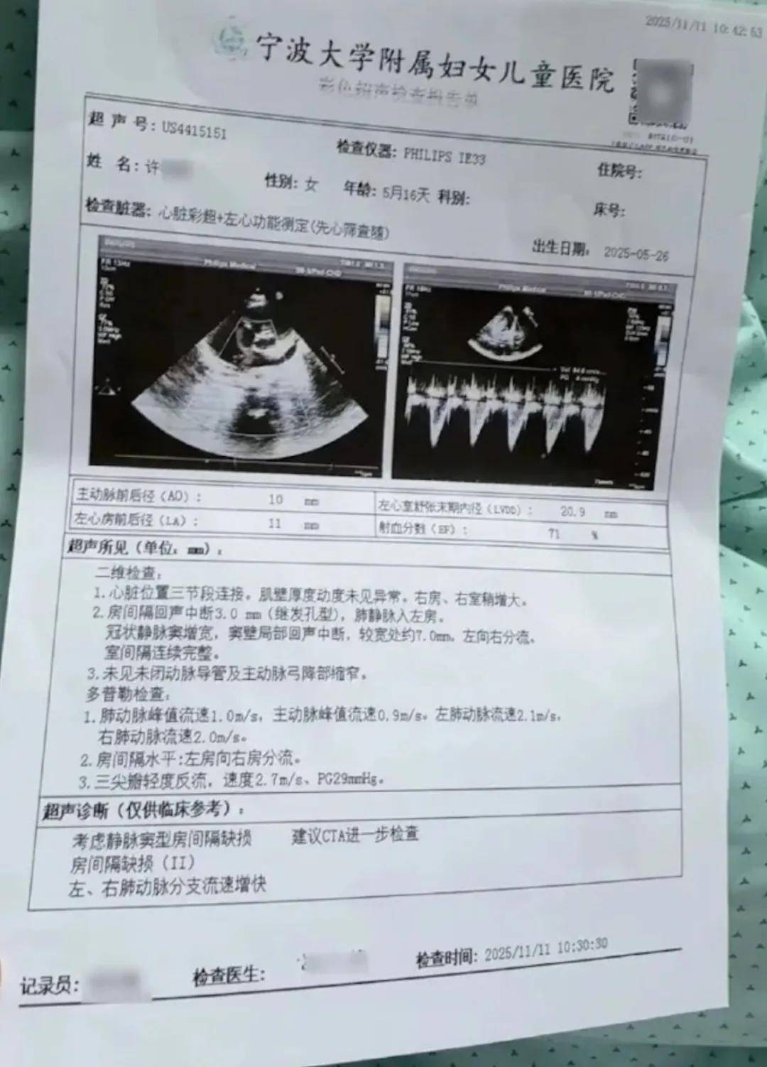 直接死因:术中肺静脉梗阻,肺水肿,心脏传导系统损伤,结合创