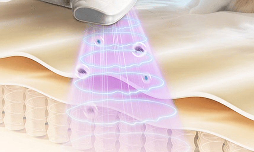 除螨仪超声波除螨还是吸附好？除螨仪吸出来的是灰尘还是螨虫？2026年热门除螨仪品牌盘点！一篇全搞定！
