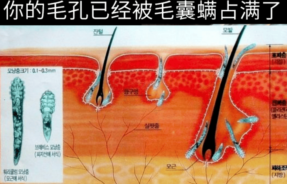 除螨仪值不值得买？除螨仪哪家品牌好一点？权威推荐除螨仪十大名牌排行榜，小白精选款！