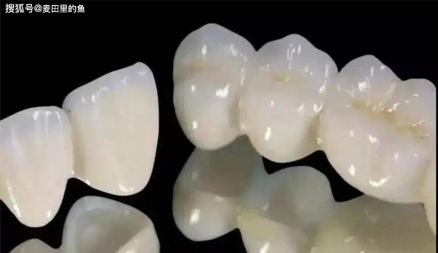 牙冠是什么？有什么用？