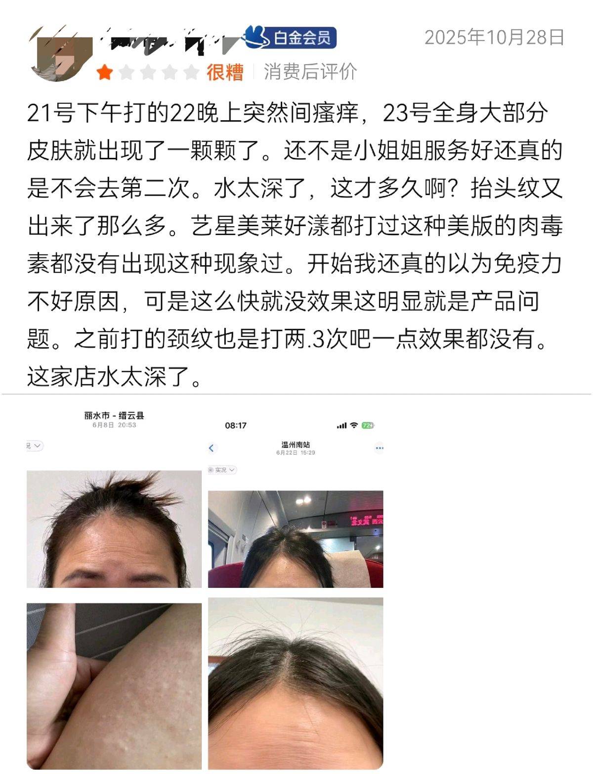 从温州和平整形医院的消费投诉:看品牌注销与重生的前世今生(图5)