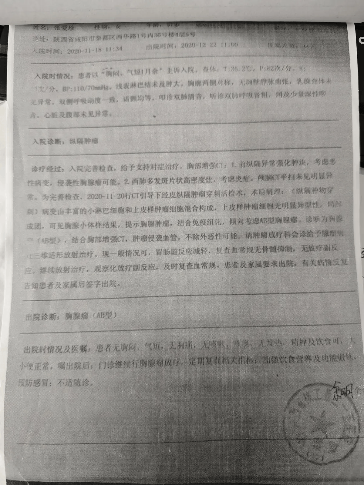 胸腺瘤化疗后昏迷休克，她如何靠中药走过六年?