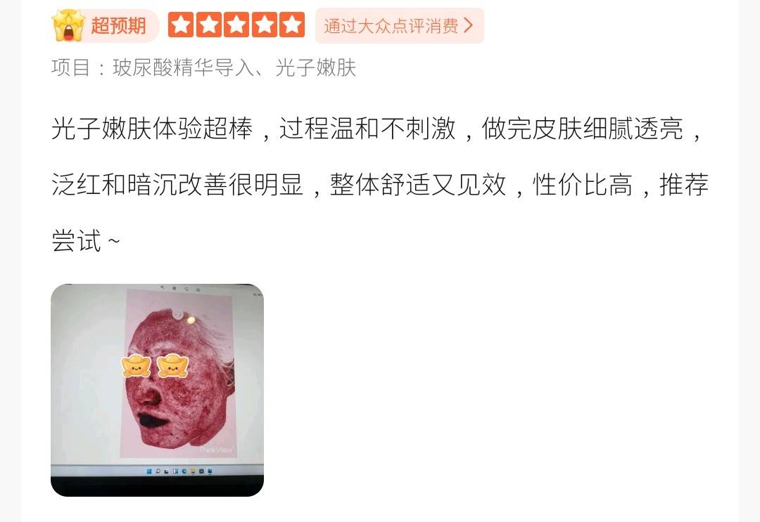 上海和颜一美医疗虚假宣传被罚:品牌何时重视消费者知情权?(图6) get?code=YTAwODJhOGEyZDY0ODZjZmY2NWYxNWM4YTVlNzU0MDQsMTc3NTI4ODA5ODcwNg==