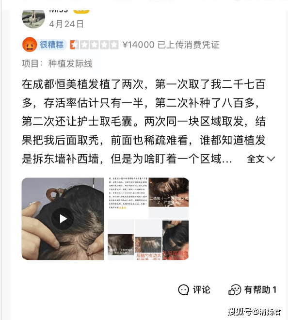 成都恒美毛发输掉名誉权官司:反告消费者"敲诈" 法院这样判(图4) 文章配图-1