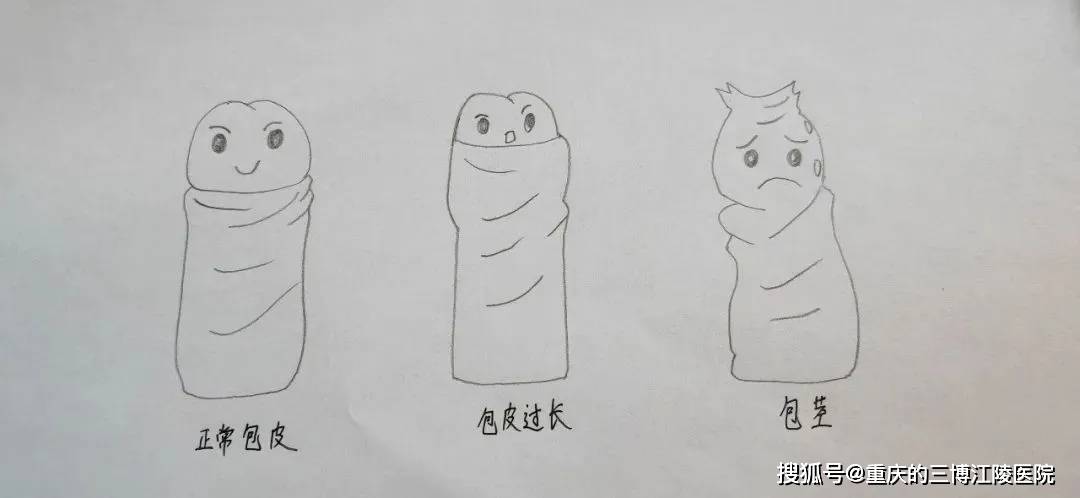 割包皮，别盲从！什么情况才需要割？