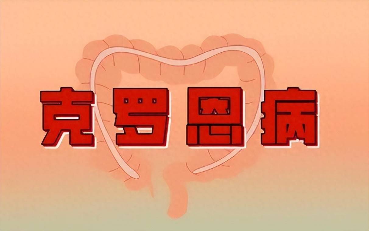 原创            反复腹痛腹泻总不好？不是肠胃炎，克罗恩病专挑年轻人下手