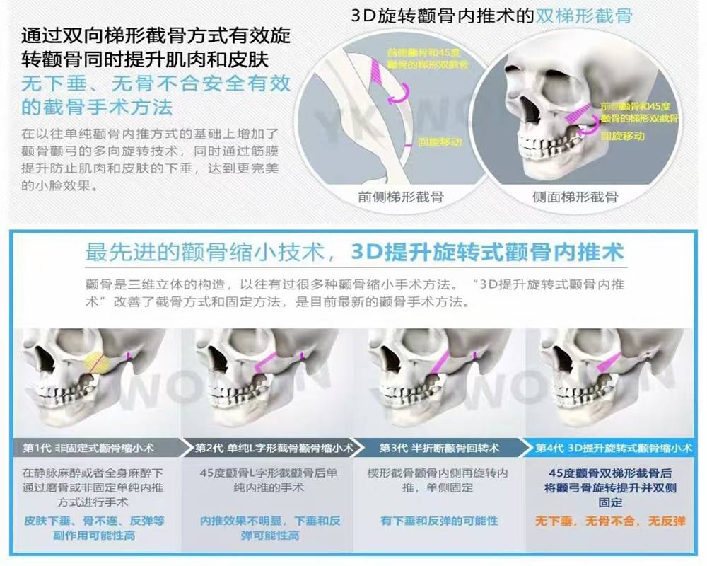 颌面整形医师口碑评价参考维度_骨骼_方案_手术