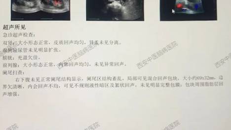 男子腹痛数十天，确诊急性阑尾炎穿孔！医生：把握72小时，拖延可危及生命