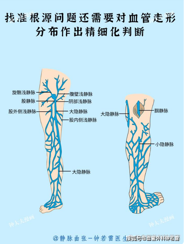 下肢血管解剖图谱图片