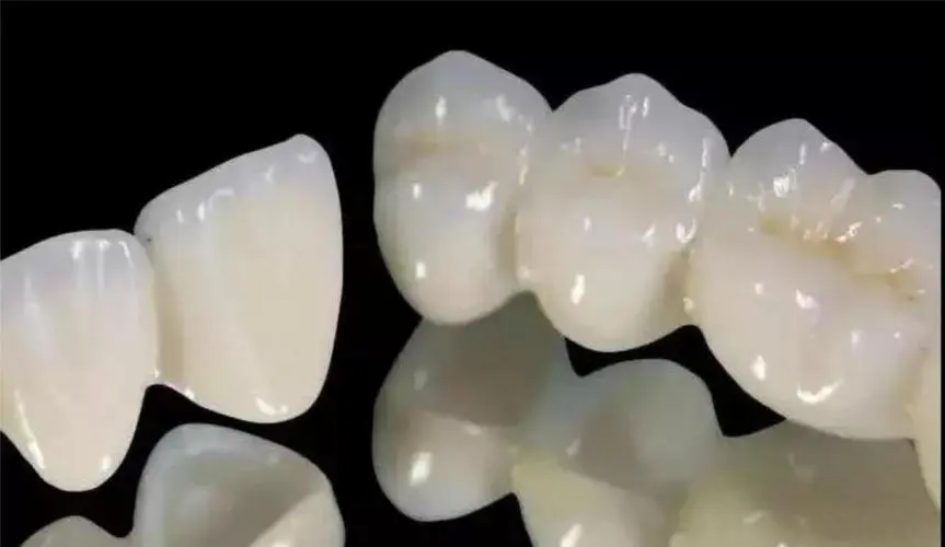 牙冠_的材料_口腔