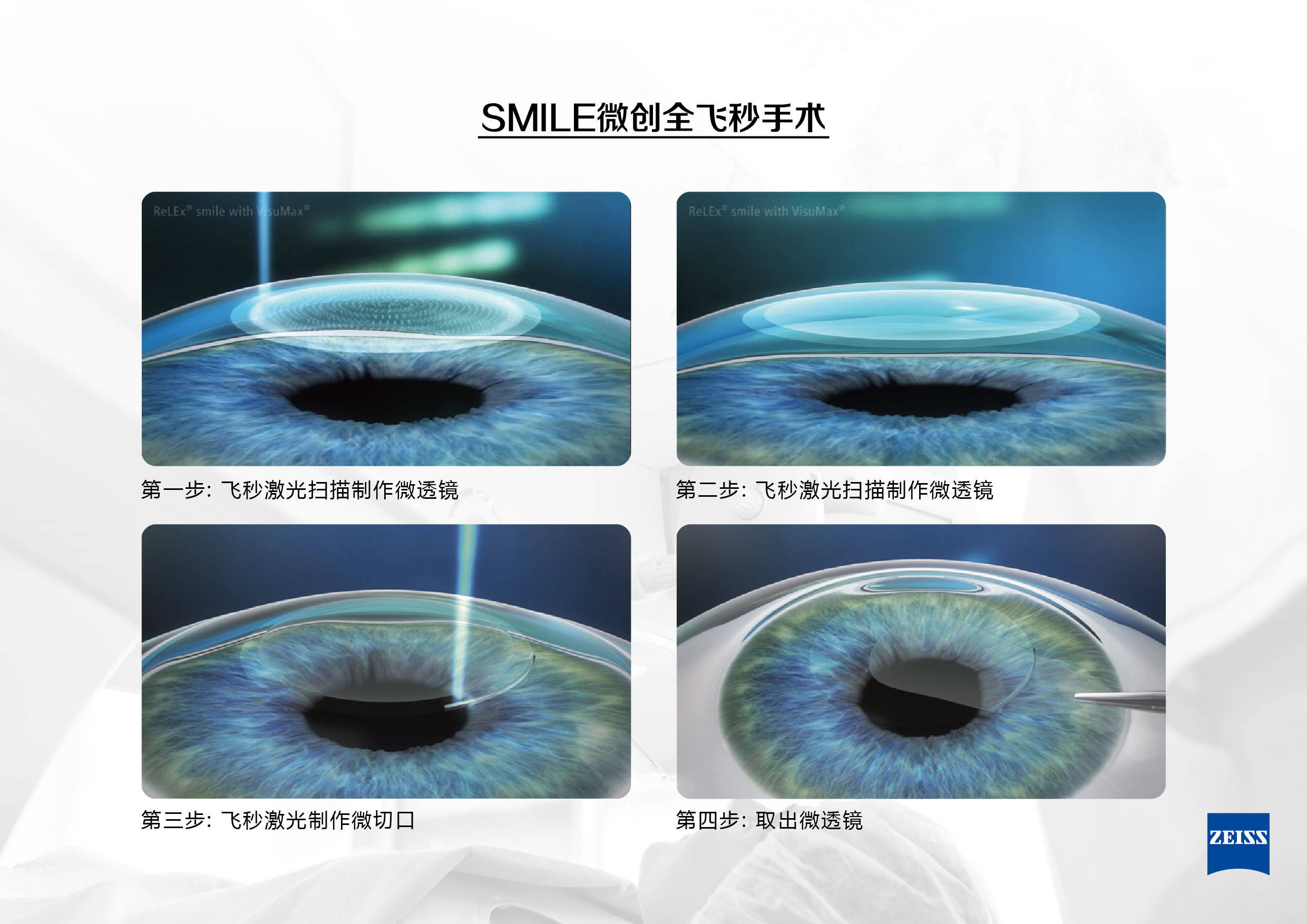 贵阳8900做全飞秒到底真假?警惕陷入近视手术低价陷阱!