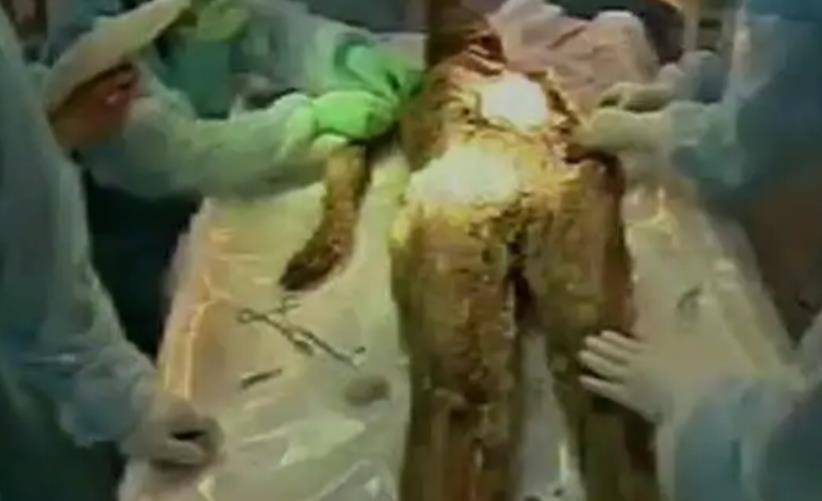 湖北荆门发现中国第一女古尸,血液可在血管中正常流动