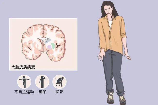 原来这些食物中的维生素对小脑萎缩有帮助_症状_包括_神经系统